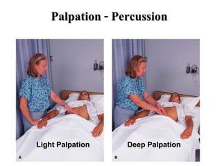 Palpation - Percussion
Light Palpation Deep Palpation
 