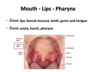 Mouth - Lips - Pharynx
- สังเกต lips, buccal mucosa, teeth, gums and tongue
- สังเกต uvula, tonsil, pharynx
 