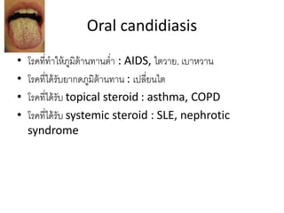 Oral candidiasis
• โรคที่ทาให้ภูมิต้านทานต่า : AIDS, ไตวาย, เบาหวาน
• โรคที่ได้รับยากดภูมิต้านทาน : เปลี่ยนไต
• โรคที่ได้รับ topical steroid : asthma, COPD
• โรคที่ได้รับ systemic steroid : SLE, nephrotic
syndrome
 
