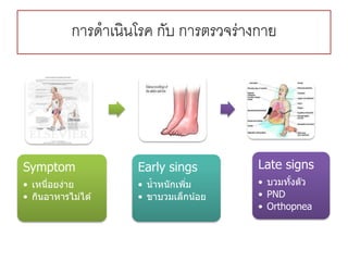 การดาเนินโรค กับ การตรวจร่างกาย
Symptom
• เหนื่อยง่าย
• กินอาหารไม่ได ้
Early sings
• น้าหนักเพิ่ม
• ขาบวมเล็กน้อย
Late signs
• บวมทั้งตัว
• PND
• Orthopnea
 