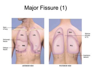 Major Fissure (1)
 