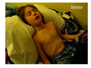 Stridor
 