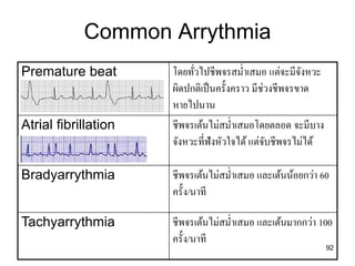 92
Common Arrythmia
Premature beat โดยทั่วไปชีพจรสม่ำเสมอ แต่จะมีจังหวะ
ผิดปกติเป็นครั้งครำว มีช่วงชีพจรขำด
หำยไปนำน
Atrial fibrillation ชีพจรเต้นไม่สม่ำเสมอโดยตลอด จะมีบำง
จังหวะที่ฟังหัวใจได้ แต่จับชีพจรไม่ได้
Bradyarrythmia ชีพจรเต้นไม่สม่ำเสมอ และเต้นน้อยกว่ำ 60
ครั้ง/นำที
Tachyarrythmia ชีพจรเต้นไม่สม่ำเสมอ และเต้นมำกกว่ำ 100
ครั้ง/นำที
 