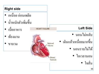 Right side
• เหนื่อย อ่อนเพลีย
• น้ำหนักตัวเพิ่มขึ้น
• เบื่ออำหำร
• ท้องมำน
• ขำบวม
Left Side
• นอนไม่หลับ
• เดินแล้วเหนื่อยมำกขึ้น
• นอนรำบไม่ได้
• ไอเวลำนอน
• ใจสั่น
99
 
