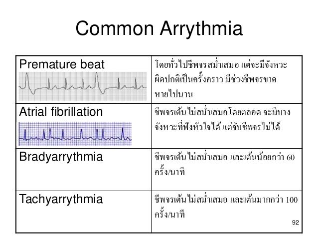 Atrial fibrillation and viagra