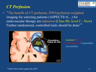 CT Perfusion
•  “The benefit of CT perfusion, DWI/perfusion-weighted
imaging for selecting patients (ASPECTS<6…) for
endovascular therapy are unknown (Class IIb; level C - New).
Further randomized, controlled trials should be done*”
*AHA/ASA-stroke guide line 2015
Lesions = Core
(irreversible )+ penumbra
(reversible)
12	
 