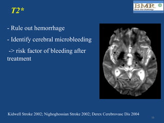 - Rule out hemorrhage
- Identify cerebral microbleeding
-> risk factor of bleeding after
treatment
T2*
Kidwell Stroke 2002; Nighoghossian Stroke 2002; Derex Cerebrovasc Dis 2004
16	
 