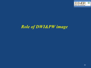 Role of DWI&PW image
33	
 