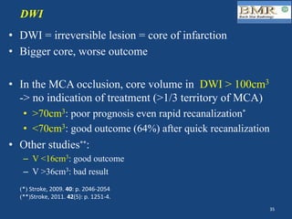 •  DWI = irreversible lesion = core of infarction
•  Bigger core, worse outcome
•  In the MCA occlusion, core volume in DWI > 100cm3
-> no indication of treatment (>1/3 territory of MCA)
•  >70cm3: poor prognosis even rapid recanalization*
•  <70cm3: good outcome (64%) after quick recanalization
•  Other studies**:
–  V <16cm3: good outcome
–  V >36cm3: bad result
DWI
(*) Stroke,	2009.	40:	p.	2046-2054
(**)Stroke,	2011.	42(5):	p.	1251-4.	
35	
 