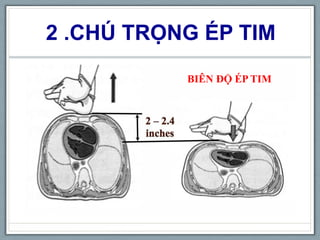 2 .CHÚ TRỌNG ÉP TIM
BIÊN ĐỘ ÉP TIM
 