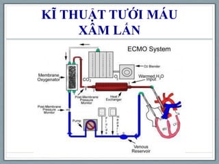 KĨ THUẬT TƯỚI MÁU
XÂM LẤN
 