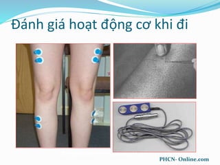 Gait Analysis: Techniques and
Recognition of Abnormal Gait
April 30, 2007
Đánh giá hoạt động cơ khi đi
PHCN- Online.com
 