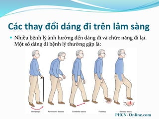 Các thay đổi dáng đi trên lâm sàng
 Nhiều bệnh lý ảnh hưởng đến dáng đi và chức năng đi lại.
Một số dáng đi bệnh lý thường gặp là:
PHCN- Online.com
 