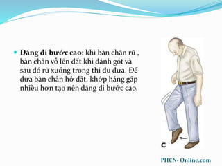  Dáng đi bước cao: khi bàn chân rũ ,
bàn chân vỗ lên đất khi đánh gót và
sau đó rũ xuống trong thì đu đưa. Để
đưa bàn chân hở đất, khớp háng gấp
nhiều hơn tạo nên dáng đi bước cao.
PHCN- Online.com
 