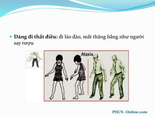  Dáng đi thất điều: đi lảo đảo, mất thăng bằng như người
say rượu
PHCN- Online.com
 