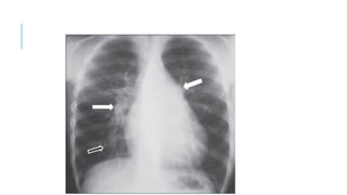 Comprehensive Guide to Chest X-Ray Analysis and Interpretation in ...