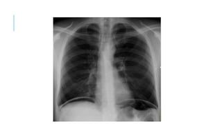 Comprehensive Guide to Chest X-Ray Analysis and Interpretation in ...