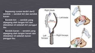 16
❑Sepasang cunam terdiri dari2
sendok → sendok kiri dan sendok
kanan
❑Sendok kiri → sendok yang
dipegang oleh tangan kiri dan
diletakkan di sebelah kiri panggul
ibu
❑Sendok kanan → sendok yang
dipegang oleh tangan kanan dan
diletakkan di sebelah kanan
panggul ibu.
 
