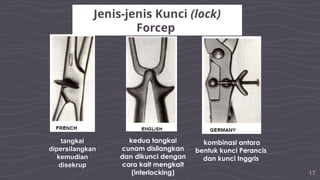 17
tangkai
dipersilangkan
kemudian
disekrup
kedua tangkai
cunam disilangkan
dan dikunci dengan
cara kait mengkait
(interlocking)
kombinasi antara
bentuk kunci Perancis
dan kunci Inggris
Jenis-jenis Kunci (lock)
Forcep
 