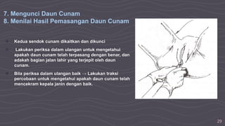 29
○ Kedua sendok cunam dikaitkan dan dikunci
○ Lakukan periksa dalam ulangan untuk mengetahui
apakah daun cunam telah terpasang dengan benar, dan
adakah bagian jalan lahir yang terjepit oleh daun
cunam.
○ Bila periksa dalam ulangan baik → Lakukan traksi
percobaan untuk mengetahui apakah daun cunam telah
mencekram kepala janin dengan baik.
7. Mengunci Daun Cunam
8. Menilai Hasil Pemasangan Daun Cunam
 