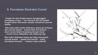 32
○ Tangan kiri dan tangan kanan menggenggam
pemegang cunam, → jari telunjuk dan jari tengah
tangan kanan diluruskan sampai menyentuh puncak
kepala
○ Bila pada waktu traksi dilakukan, kedua jari terlepas
dari puncak kepala →kepala tidak ikut tertarik →
daun cunam belum terpasang dengan benar
→cunam harus dilepaskan dan dipasang lagi
○ Bila traksi dilakukan kedua jari tetap menyentuh
puncak kepala → kepala ikut tertarik→ traksi
percobaan berhasil → lakukan traksi definitif.
9. Percobaan Ekstraksi Cunam
 