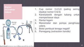 Bagian
Ekstraktor
Vakum
49
1. Cup nomor 3,4,5,6 (paling sering
dipakai nomor 5 & 6)
2. Karet/plastik dengan lubang untuk
memperbesar daya
3. Rantai logam
4. Manometer dan pompa penghisap
udara.
5. Botol pembuat tenaga negatif
6. Pemegang (extraction handle)
 