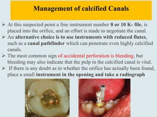  At this suspected point a fine instrument number 8 or 10 K- file, is
placed into the orifice, and an effort is made to negotiate the canal.
 An alternative choice is to use instruments with reduced flutes,
such as a canal pathfinder which can penetrate even highly calcified
canals.
 The most common sign of accidental perforation is bleeding, but
bleeding may also indicate that the pulp in the calcified canal is vital.
 If there is any doubt as to whether the orifice has actually been found,
place a small instrument in the opening and take a radiograph
Management of calcified Canals
 