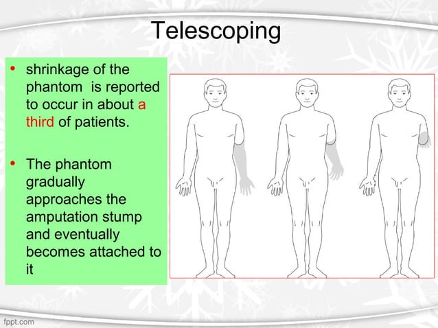 Phantom Rib Pain Phantom limb pain | PPT | Brain and Nervous System Disorders | Diseases ...