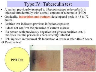 Ppd Amount Injected Pharm immuno17-18 hypersensitivity por | PPT