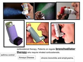 corticosteroid therapy. Patients on regular bronchodilator
therapy who require inhaled corticosteroids.
Airways Disease chronic bronchitis and emphysema.
asthma control
 