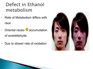• Rate of Metabolism differs with
race
• Oriental races- accumulation
of acetaldehyde.
• Due to slower rate of oxidation
of acetaldehyde as a result of
genetic polymorphism
Especially in
Japanese
 