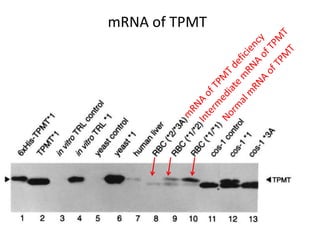 mRNA of TPMT
 