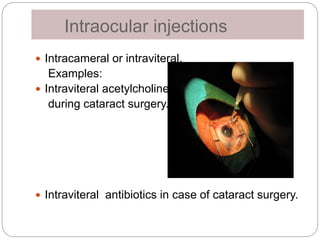 Ivta Injection Pharmacokinetics and toxicology of ocular therapy | PPTX