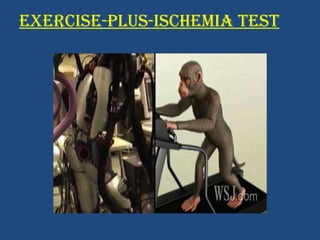 EXERCISE-PLUS-ISCHEMIA TEST 