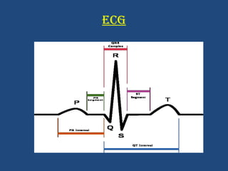 ECG 