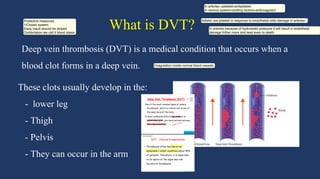 Pharmacology deep venous thrombosis prophylaxis | PDF
