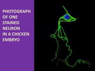 PHOTOGRAPH
OF ONE
STAINED
NEURON
IN A CHICKEN
EMBRYO
 