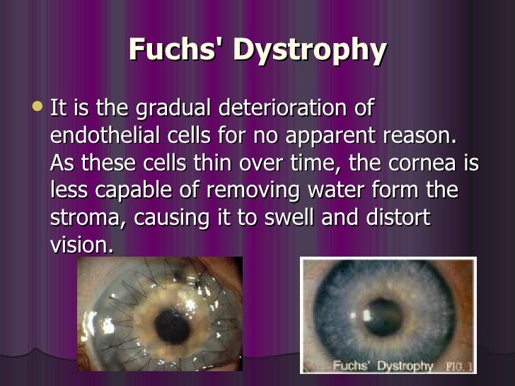 pharmacology eye disorders 52 728