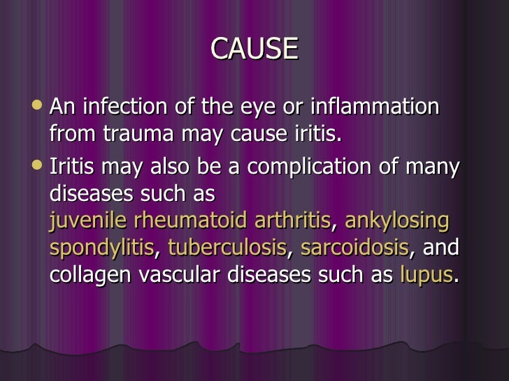 What causes iritis?