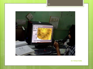 51

Dr. Rohan Kolla

 