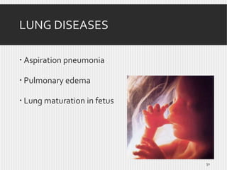 LUNG DISEASES
 Aspiration pneumonia
 Pulmonary edema
 Lung maturation in fetus

51

 