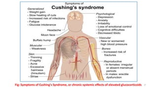Fig: Symptoms of Cushing's Syndrome, or chronic systemic effects of elevated glucocorticoids 37
 