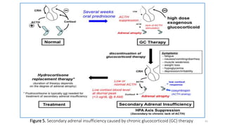 Figure 5. Secondary adrenal insufficiency caused by chronic glucocorticoid (GC) therapy 41
 