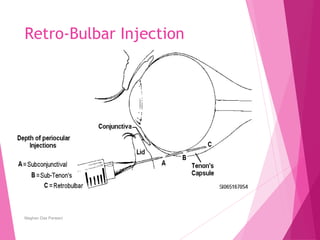 Bulbar Injection Scale Pharmacology of opthamology. by maghan das | PPT
