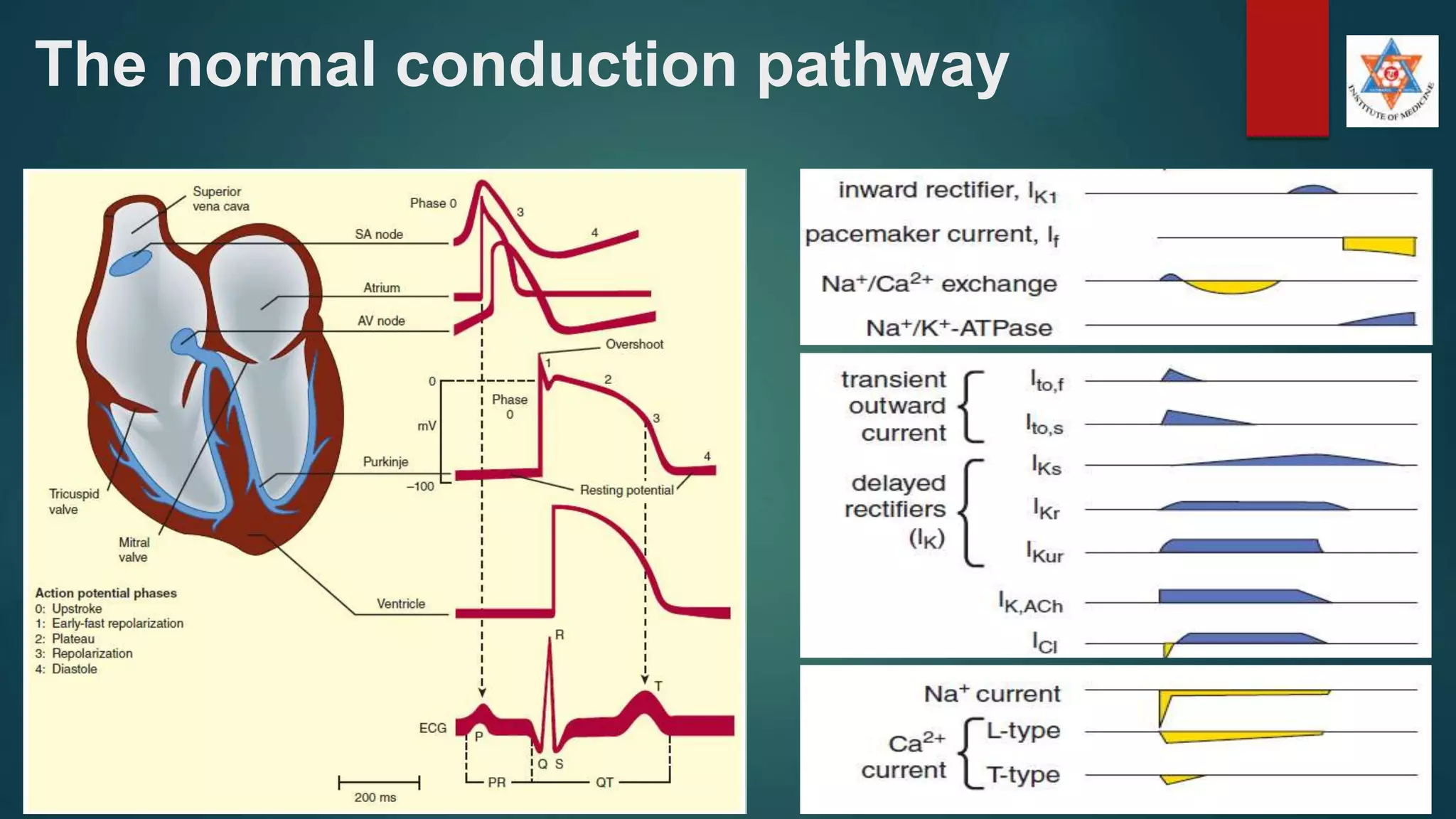 The normal conduction pathway
 