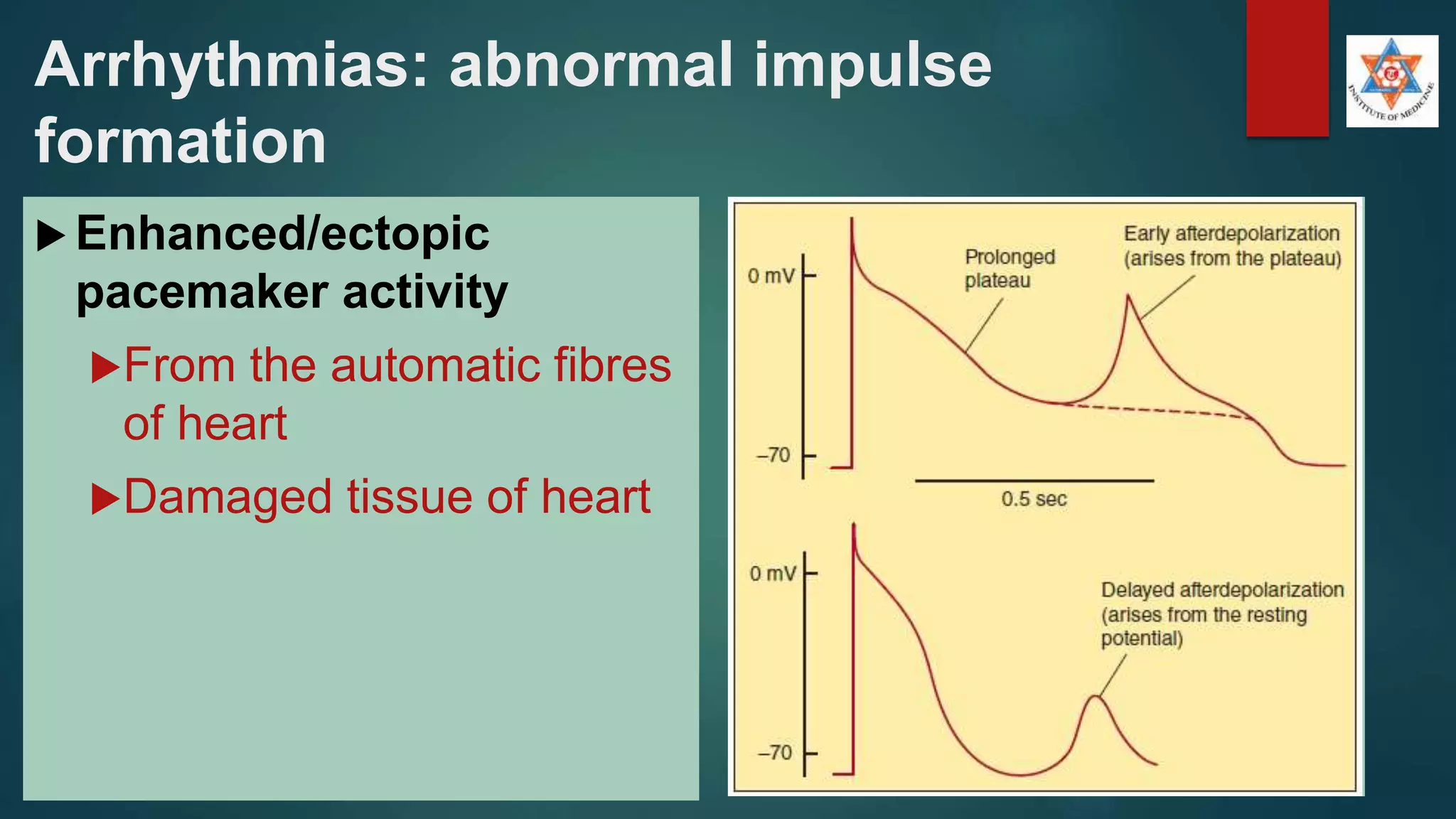 Arrhythmias: abnormal impulse
formation
 Enhanced/ectopic
pacemaker activity
From the automatic fibres
of heart
Damaged tissue of heart
 