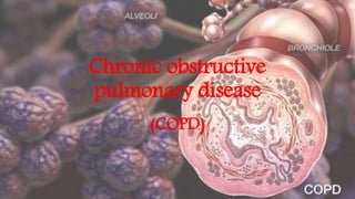 Chronic obstructive
pulmonary disease
(COPD)
 
