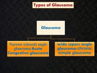 Drainage of aqueous humor occurs by 2 routes
Types of Glaucoma
Glaucoma
Narrow (closed) angle
glaucoma/Acute
Congestive glaucoma
wide (open) angle
glaucoma/chronic
simple glaucoma
 
