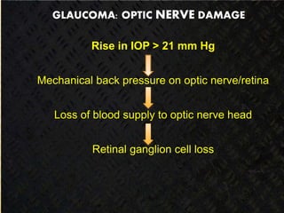 GLAUCOMA: OPTIC NERVE DAMAGE
Rise in IOP > 21 mm Hg
Mechanical back pressure on optic nerve/retina
Loss of blood supply to optic nerve head
Retinal ganglion cell loss
 