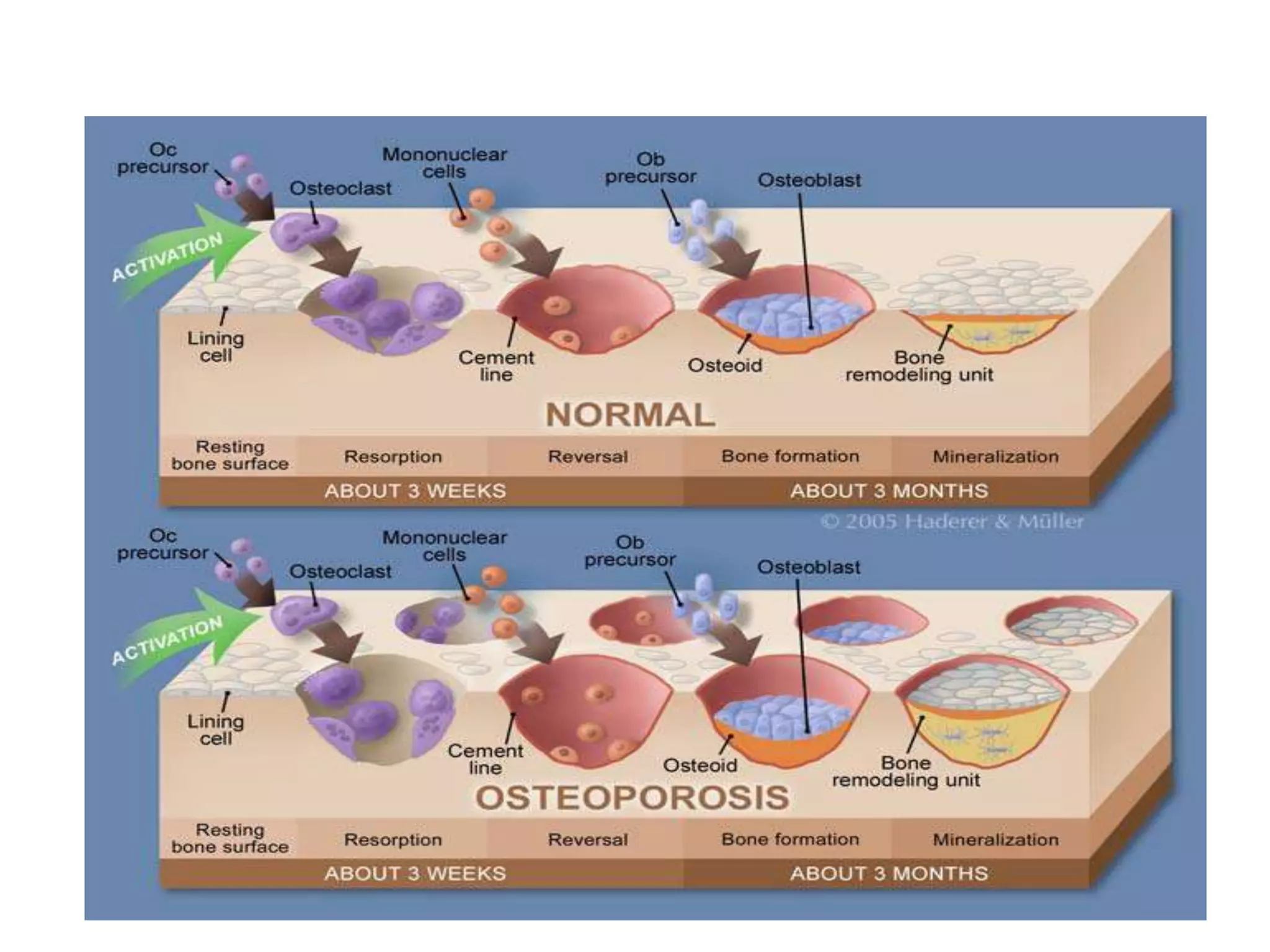 Pharmacotherapy of osteoporosis | PPTX